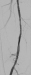 Abb. 3: A. femoralis superficialis