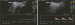 Abb. 2: Ilio-femoraler Bypass
