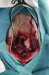 Abb. 3: Intraoperative Fotografie