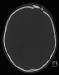 Abb. 4: Nativ-CCT
