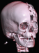 Abb. 5: 3D-Rekonstruktion