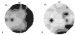 Aktuelles Bild - Abb. 6A-B: Perimetrie