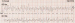Abb. 1: ECG