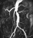 Abb. 2: MR-Angiographie