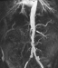 Abb. 3: MR-Angiographie