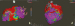 Abb. 2: Ergometrie-EKG