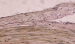 Abb. 1: CFA wall