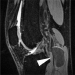 Abb. 5: Sacciformes PAA