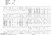 Abb. 1: FBI-Tachykardie