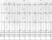 Aktuelles Bild - Abb. 3: Ruhe-EKG