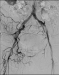 Aktuelles Bild - Abb. 4: Subtraktionsangiographie