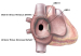 Abb. 1: Interatriales Septum