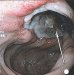 Abb. 6:  Duodenum