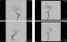 Abb. 1C: Erste konventionelle Angiographie