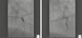 Aktuelles Bild - Abb. 4: LAO-Projektion