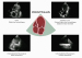 Aktuelles Bild - Abb. 1: POCUS TTE & LUS - PSAX