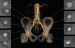 Abb. 1: Aorta abdominalis - Beckengefe