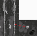 Abb. 2: Arteria iliaca