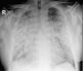 Aktuelles Bild - Abb. 2: Radiologischer Befund