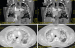 Abb. 3: CT-Angiographie