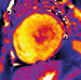 Aktuelles Bild - Abb. 3: Short-axis view T1 mapping