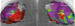 Abb. 2: Voltage-Map