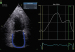 Abb. 2: 2D-Strain