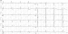 Abb. 2: Ruhe-EKG