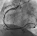 Aktuelles Bild - Abb. 2c: Angiographie