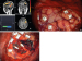 Abb. 4A-C: Intraoperative Stimulation