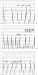 Aktuelles Bild - Abb. 2: EKG
