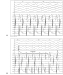 Abb. 3: EKG