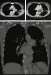 Abb. 2: CT