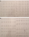 Abb. 1: EKG