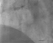 Abb. 1: Angiographie