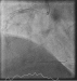 Abb. 2: CTO