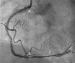 Aktuelles Bild - Abb. 3: Angiographie
