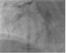 Abb. 11: RCA - ISR