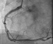 Abb. 12: Angiographie