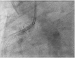Abb. 15: Angiographie