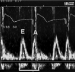 Abb. 4: Echo