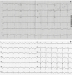 Abb. 3: EKG