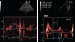 Abb. 10: Doppler