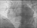 Aktuelles Bild - Abb. 2: OCT
