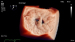 Abb. 2: Echo-Bild Online 2