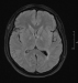 Abb. 2: MRT des Gehirns