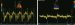 Abb. 1: Gewebedopplermuster