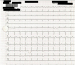 Aktuelles Bild - Abb. 1: EKG