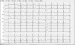 Abb. 1: 12-Ableitungs-EKG