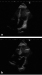 Abb. 2a-b: Echokardiographie